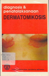 Diagnosis dan Penatalaksanaan Dermatomikosis