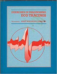 Exercises in Diagnosing ECG Tracings
