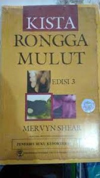 Kista Rongga Mulut