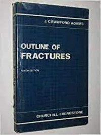 Outline Of Fractures
