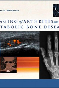 Imaging of Arthritis and Metaboli Bone Disease