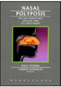 Nasal Polyposis : An Inflammatory Disease and Its Treatment